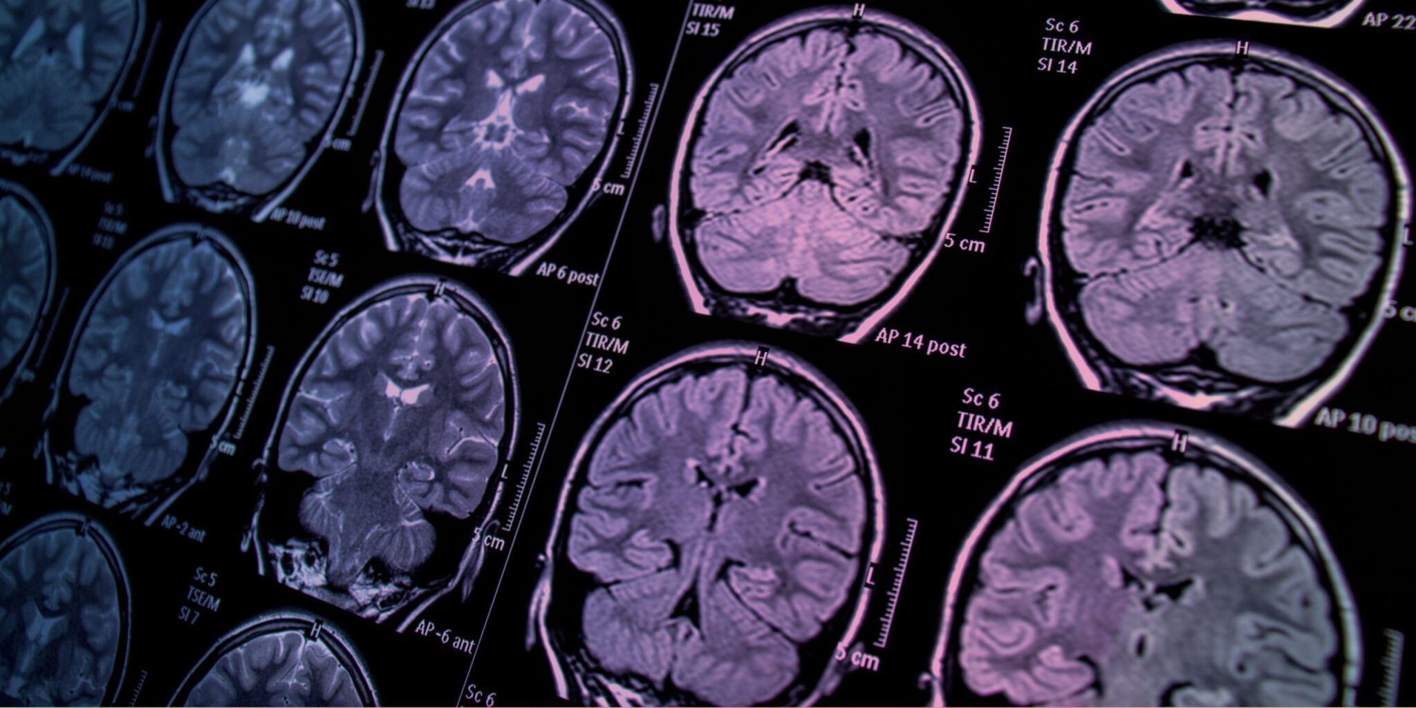What Can Brain Scans Really Tell Us?